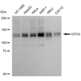 KD-Validated GTF2I Rabbit mAb (20 μl)