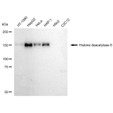 KD-Validated HDAC6 Rabbit mAb (20 μl)