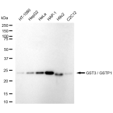 KD-Validated GSTP1 Rabbit mAb (20 μl)