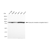 KD-Validated EEF2 Rabbit mAb (20 μl)