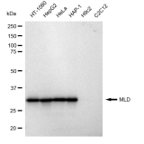 KD-Validated MLD Rabbit mAb (20 μl)