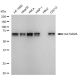 KD-Validated GATAD2A Rabbit mAb (20 μl)