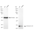 KD-Validated FOXO4 Rabbit mAb (20 μl)