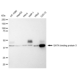 KD-Validated GATA3 Rabbit mAb (20 μl)