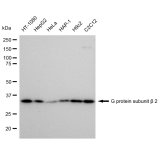 KD-Validated GNB2 Rabbit mAb (20 μl)