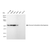 KD-Validated G6PD Rabbit mAb (20 μl)