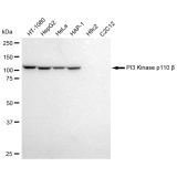 KD-Validated PI3KCB Rabbit mAb (20 μl)