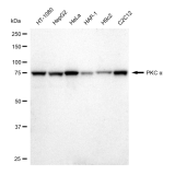 KD-Validated PKC alpha Rabbit mAb (20 μl)