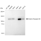 KD-Validated EphB4 Rabbit mAb (20 μl)