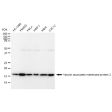 KD-Validated VAMP2 Rabbit mAb (20 μl)