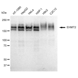 KD-Validated EHMT2 Rabbit mAb (20 μl)