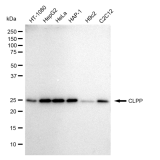 KD-Validated CLPP Rabbit mAb (20 μl)