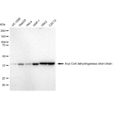 KD-Validated ACAD3 Rabbit mAb (20 μl)