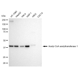 KD-Validated ACAT Rabbit mAb (20 μl)