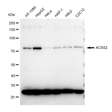 KD-Validated ACSS2 Rabbit mAb (20 μl)