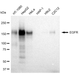 KD-Validated EGFR Rabbit mAb (20 μl)