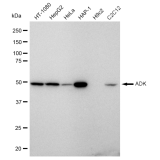 KD-Validated ADK Rabbit mAb (20 μl)