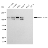 KD-Validated EHMT2 Rabbit mAb (20 μl)