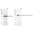 KD-Validated Phospho-PKC alpha (Ser657) Rabbit mAb (20 μl)