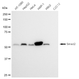 KD-Validated Smad2 Rabbit mAb (20 μl)