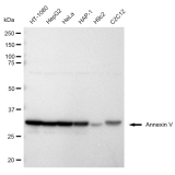 KD-Validated ANX5 Rabbit mAb (20 μl)