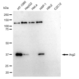 KD-Validated Arg2 Rabbit mAb (20 μl)