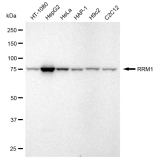 KD-Validated RRM1 Rabbit mAb (20 μl)