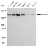 KD-Validated Tuberin Rabbit mAb (20 μl)