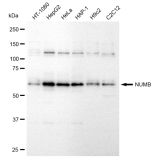 KD-Validated NUMB Rabbit mAb (20 μl)