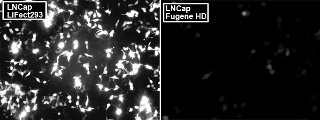 LNCap cell transfection