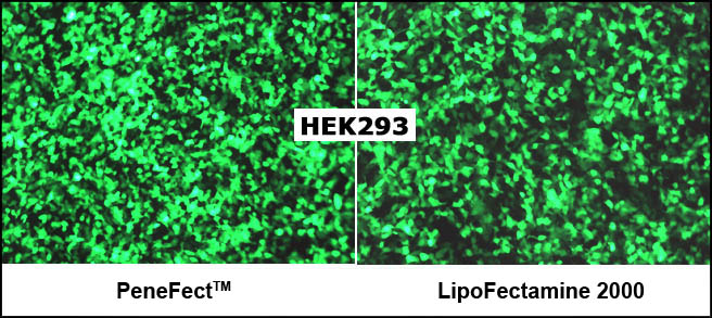 Fluorescence microscopy of HEK-293 cells transfected with PeneFect showing high GFP expression and healthy morphology.